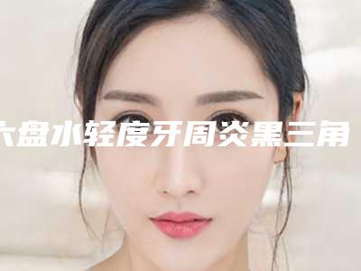 六盘水轻度牙周炎黑三角费用有人知道吗